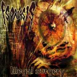 Psoriasis (FRA) : Illegal Surgery
